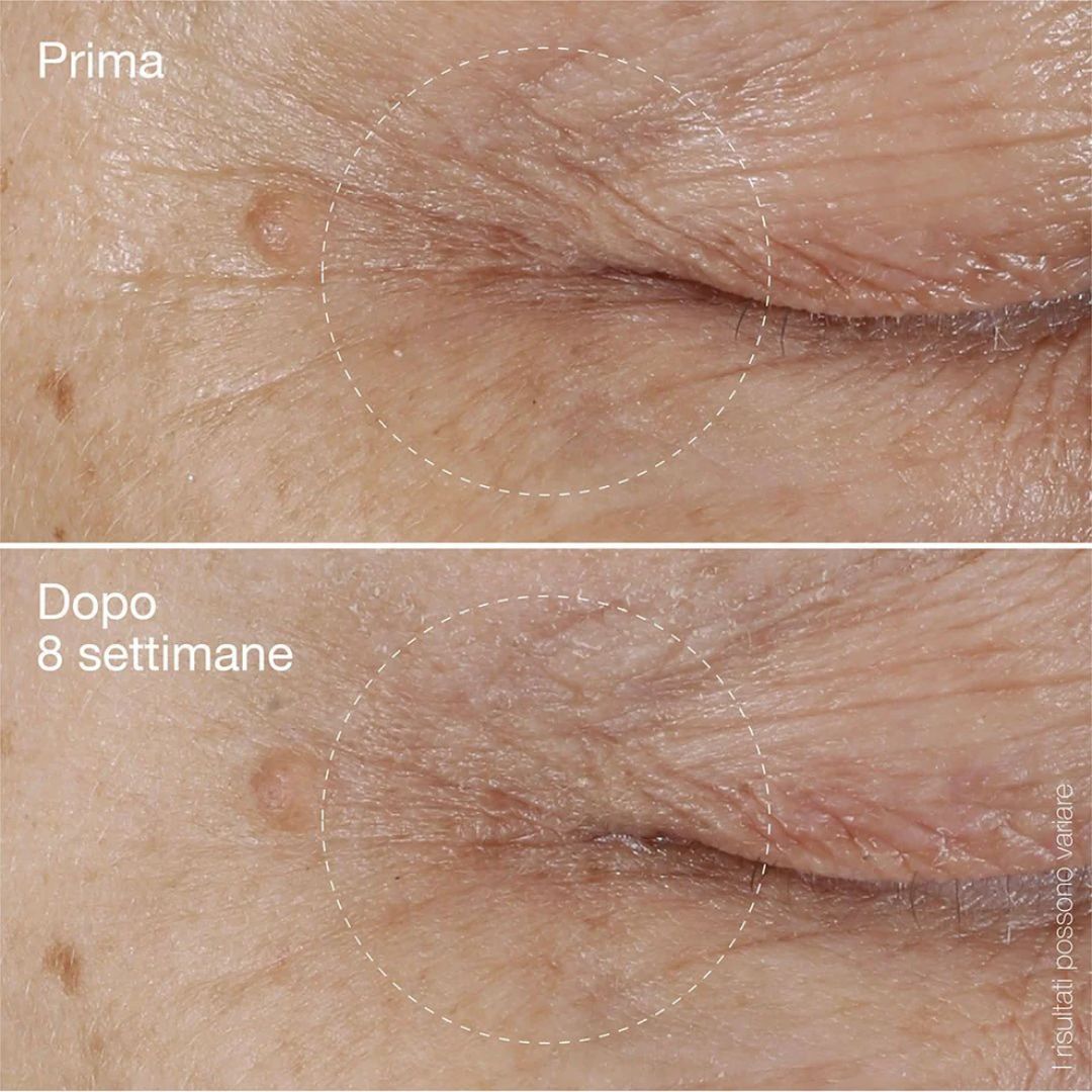 BioLumin-C Eye Serum | Siero Contorno Occhi alla Vitamina C per un Aspetto Giovane e Radioso - Dermalogica